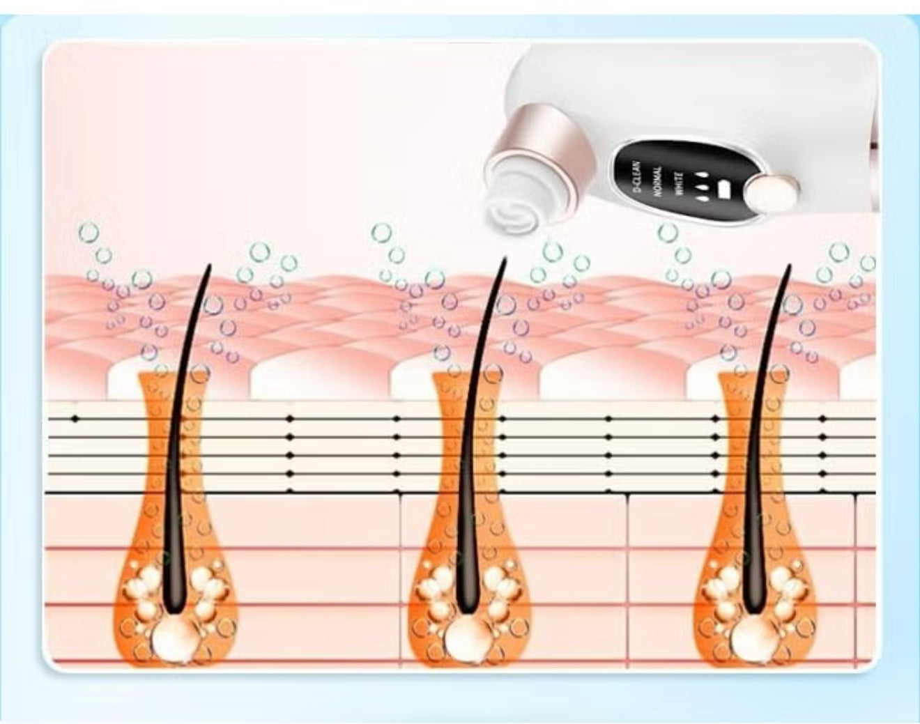 Blackhead Suction Pore Cleaner, 6 Suction Heads, 3 Modes, USB Charging Facial Cleansing, Pick Vacuum Cleaner, Device Blackhead Remover