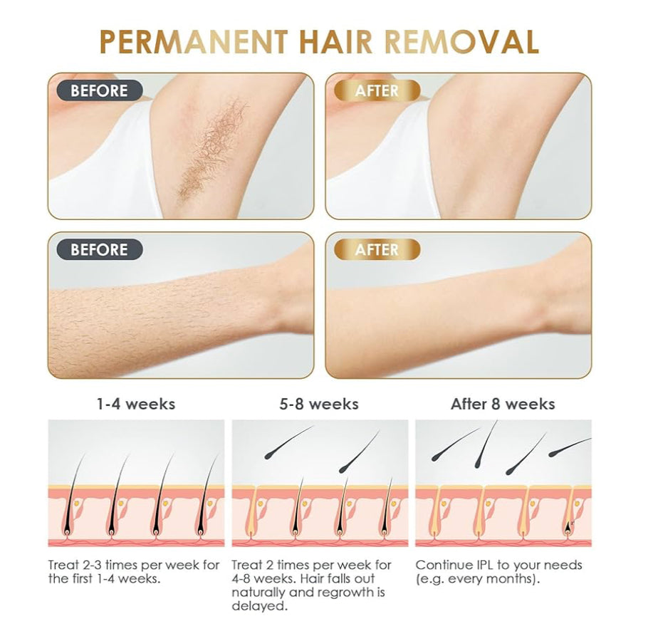 Laser Hair Removal Device at-Home for Women and Men Painless Permanent Facial Upper Lip Bikini Line Armpits Back Legs Arms Face Back Whole Body Remover
