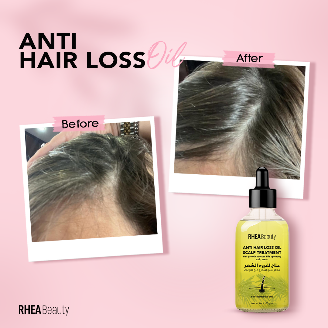 anti hair loss oil ( rosemary oil)